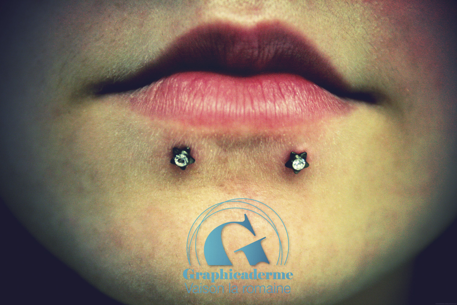 Piercing contour de bouche Graphicaderme