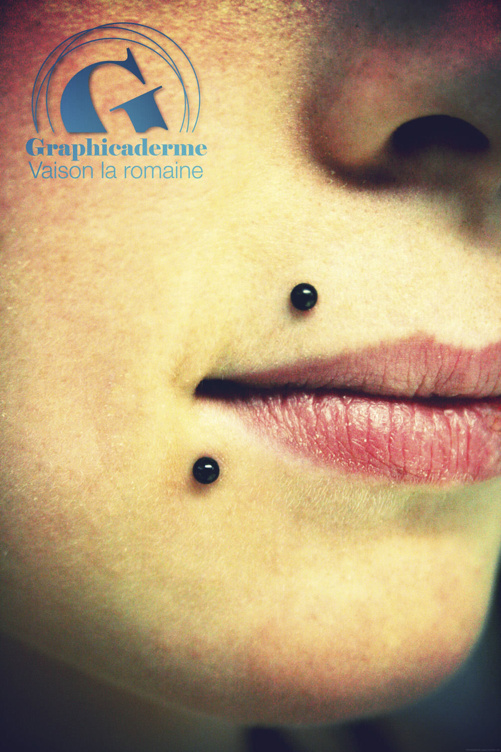 Piercing contour de bouche Graphicaderme
