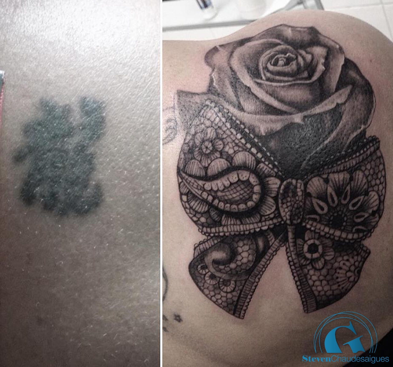 Galerie nos recouvrements de tatouage Graphicaderme