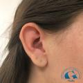 graphicaderme-nadia-orange-vaucluse-daith-daithpiercing