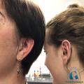 graphicaderme-piercing-lobe-helix-antihelix-daith-chantal-avignon-vaucluse