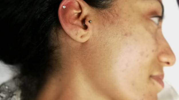 graphicaderme-chantal-piercing-avignon-tragus-vaucluse-paca