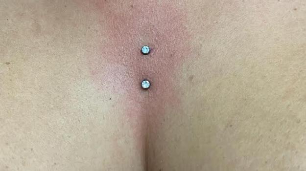 microdermal-bastia-piercing-bastia