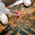 Comment_ enlever _un_ tatouage _graphicaderme
